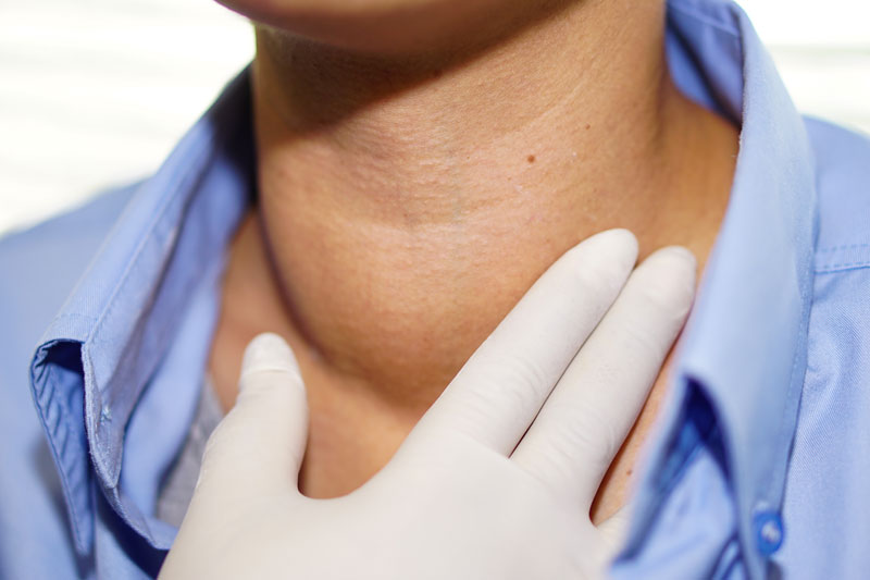 Woman having an enlarged mass on her neck inspected